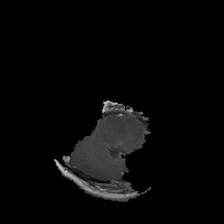 The anchor for the brain scan. Figure 2